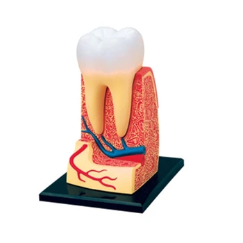 Демонстрационная модель зубов G5AA Коронка Мостовидный Протез Демонстрационная Модель Зубов Съемная Демонстрационная Обучающая Модель Зубов