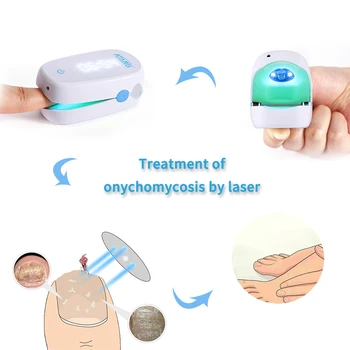 Лазерный серый инструмент для ногтей, реабилитационное средство для ног при лечении онихомикоза, инструмент для ногтей