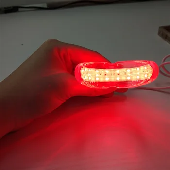 2023 Новейший лазер для полости рта и горла в физиотерапевтическом лечении язв полости рта